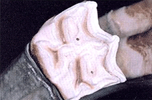 낭치 (P1)가 첫 번째 전구치처럼 보인다. 낭치는 잔류 치아로서 뿌리가 작다.